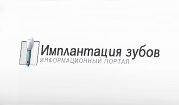 “TEETH IMPLANTATION” INFORMATION PORTAL - Կայքի ձևավորում և պատրաստում