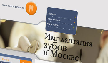 TEETH IMPLANTATION IN MOSCOW - Կայքի ձևավորում և պատրաստում
