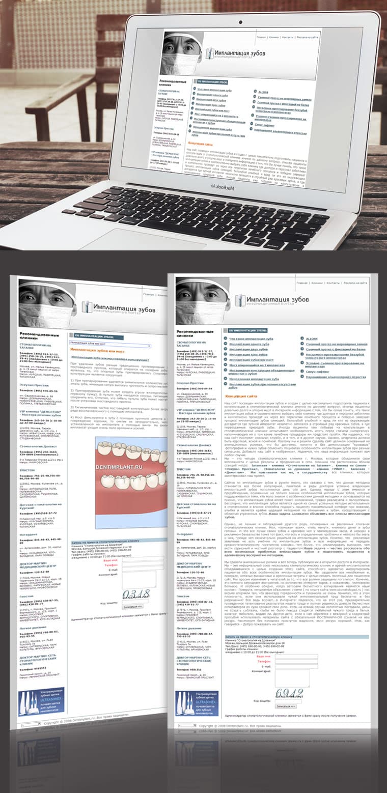 “TEETH IMPLANTATION” INFORMATION PORTAL - Կայքի ձևավորում և պատրաստում